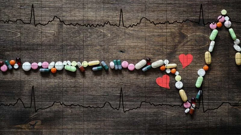 Kalp Grafisi (EKG)